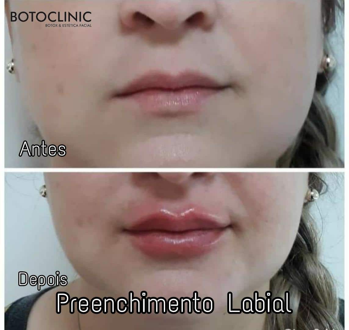 Botoclinic Valinhos Clínica de Estética SP