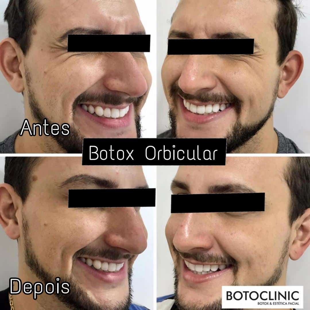 Botoclinic Valinhos Clínica de Estética SP