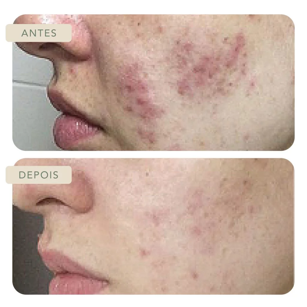 Botoclinic Valinhos Clínica de Estética SP