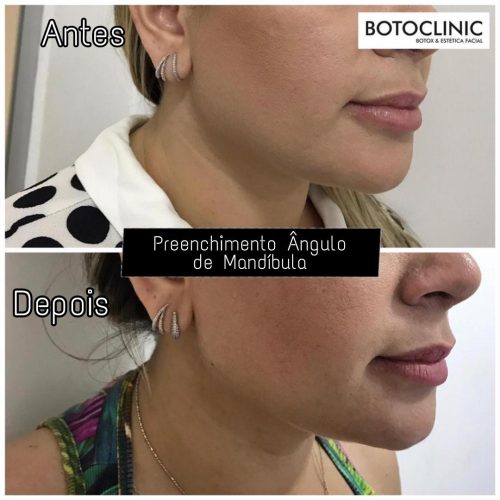 Botoclinic Valinhos Clínica de Estética SP