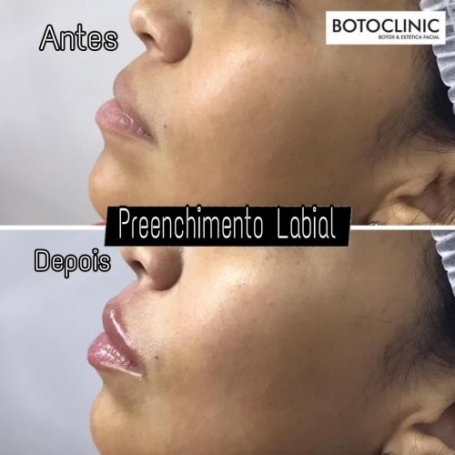 Botoclinic Valinhos Clínica de Estética SP