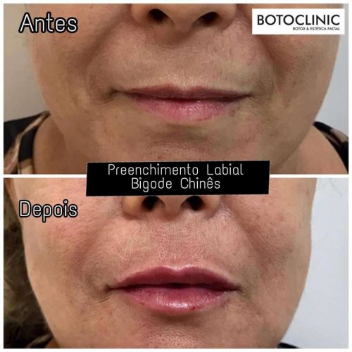Botoclinic Valinhos Clínica de Estética SP