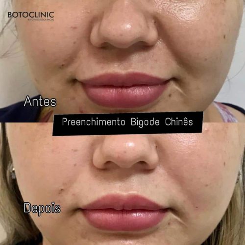 Botoclinic Valinhos Clínica de Estética SP