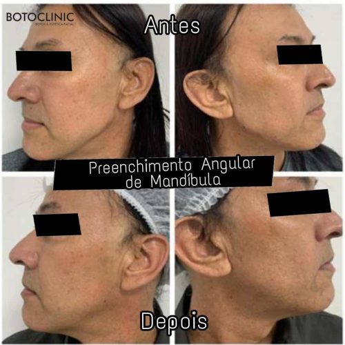 Botoclinic Valinhos Clínica de Estética SP