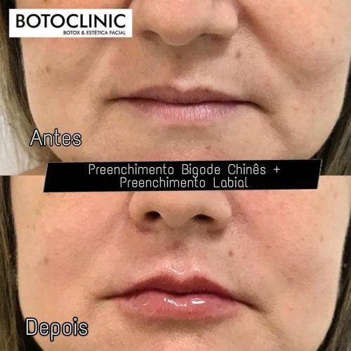 Botoclinic Valinhos Clínica de Estética SP