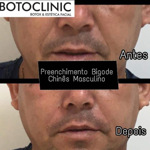 Botoclinic Valinhos Clínica de Estética SP