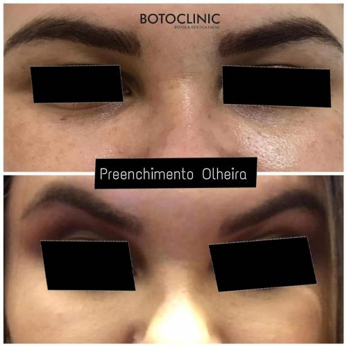 Botoclinic Valinhos Clínica de Estética SP