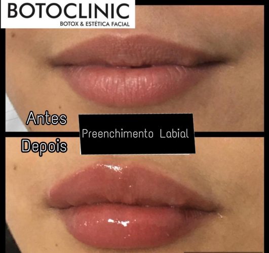 Botoclinic Valinhos Clínica de Estética SP