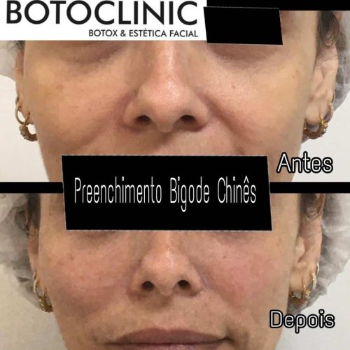 Botoclinic Valinhos Clínica de Estética SP