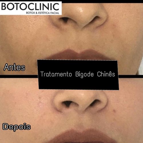 Botoclinic Valinhos Clínica de Estética SP