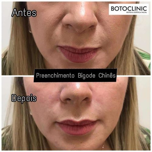 Botoclinic Valinhos Clínica de Estética SP