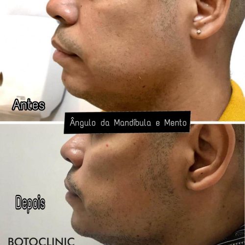 Botoclinic Valinhos Clínica de Estética SP