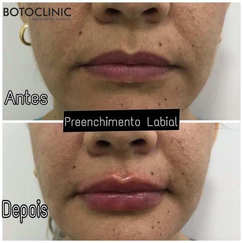 Botoclinic Valinhos Clínica de Estética SP