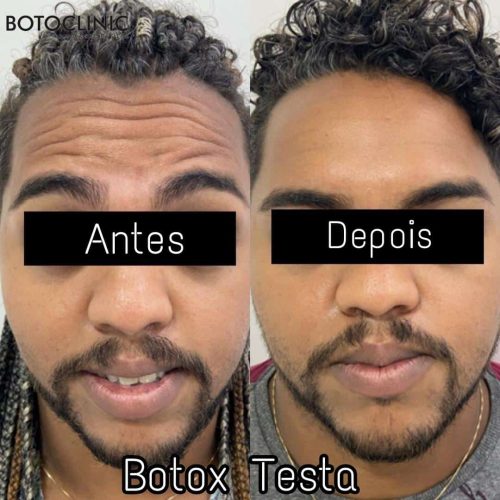 Botoclinic Valinhos Clínica de Estética SP Botoclinic Valinhos Clínica de Estética SP