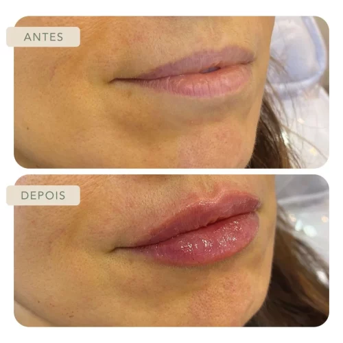 Botoclinic Valinhos Clínica de Estética SP