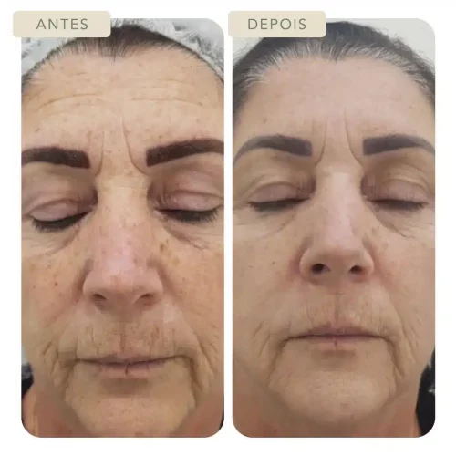 Botoclinic Valinhos Clínica de Estética SP