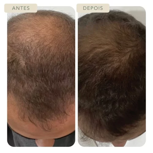 Botoclinic Valinhos Clínica de Estética SP